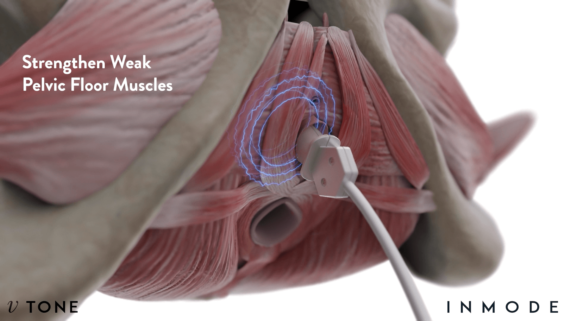 骨盆底肌強化示意圖