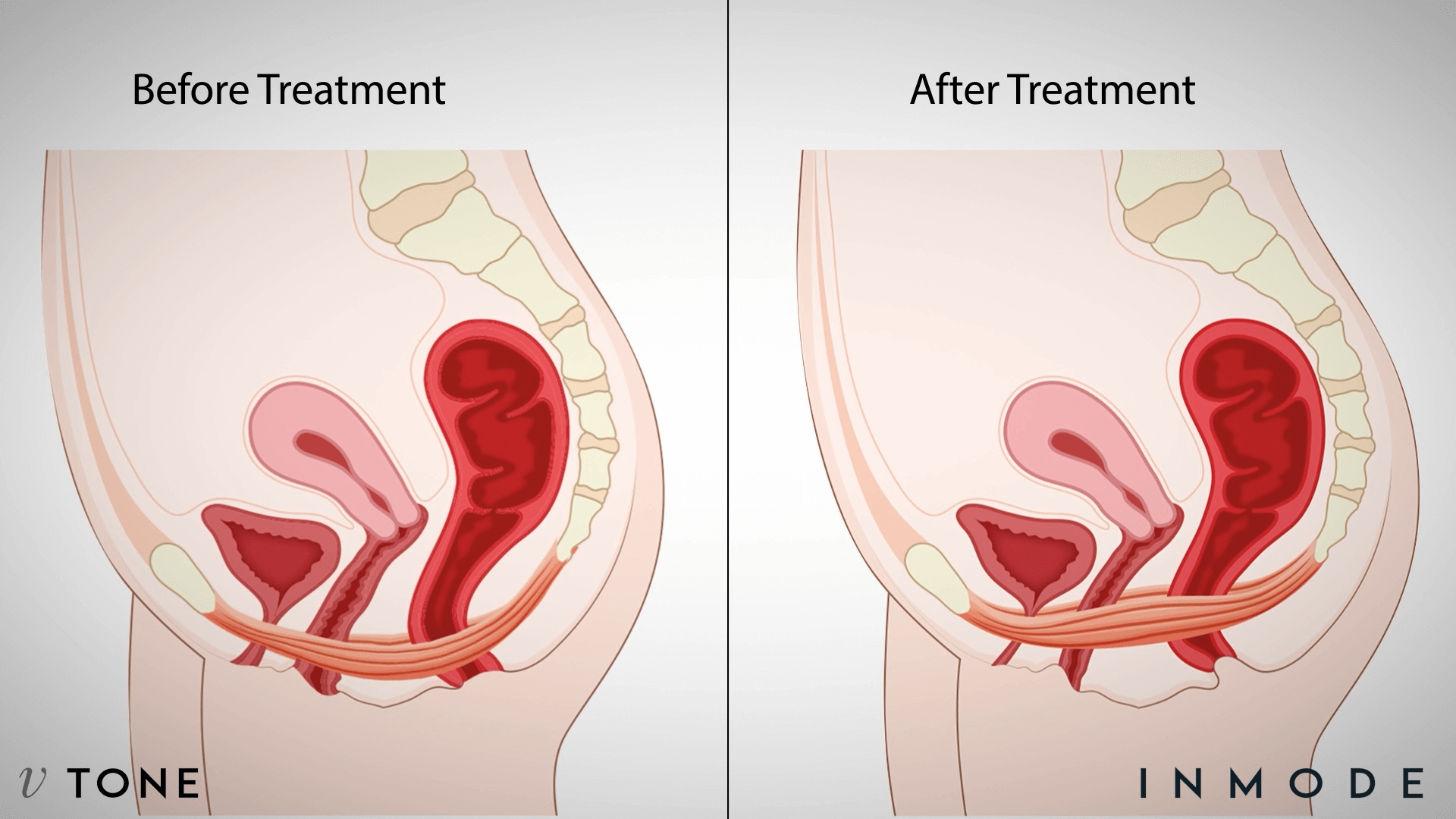 適合對象示意圖